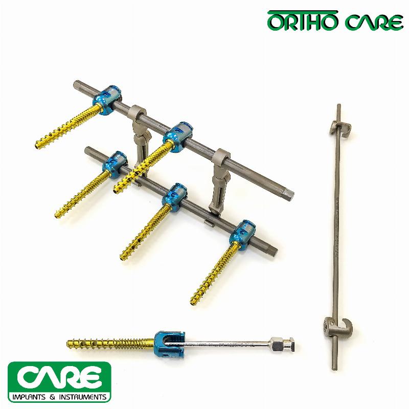 Система для транспедикулярної фіксації хребта (6 фенестрованих поліаксіальних гвинтів Ф 5.5 х 45 мм.) ORTHO CARE